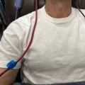 Understanding the Frequency and Duration of EBO2 Sessions: A Comprehensive Guide